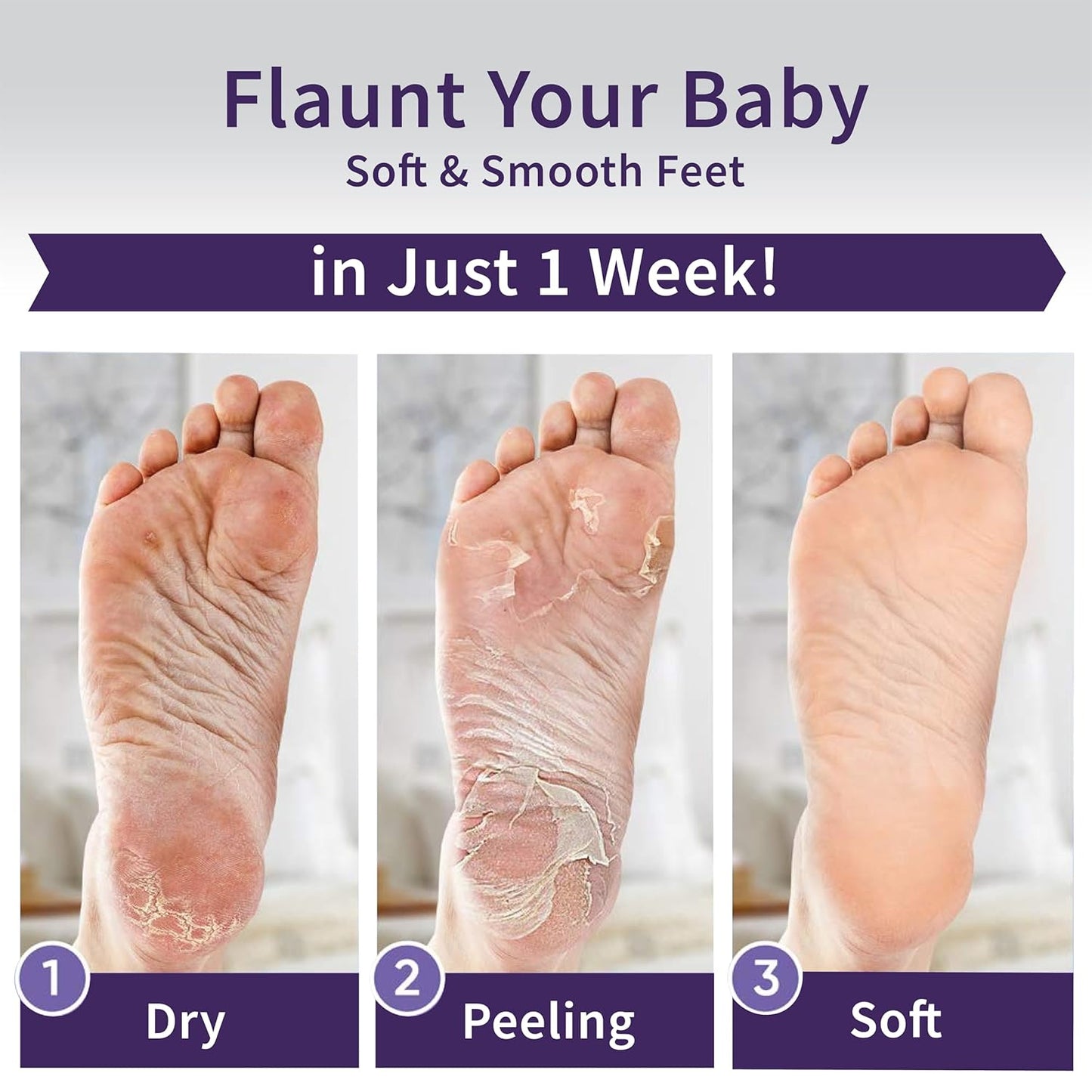 Foot Peeling Mask – Lavender Exfoliating Treatment Booties for Callus Removal & Renewal of Dry, Cracked Feet – Dermatologist-Inspired Moisturizing Spa Therapy for Men & Women (2 Pairs)