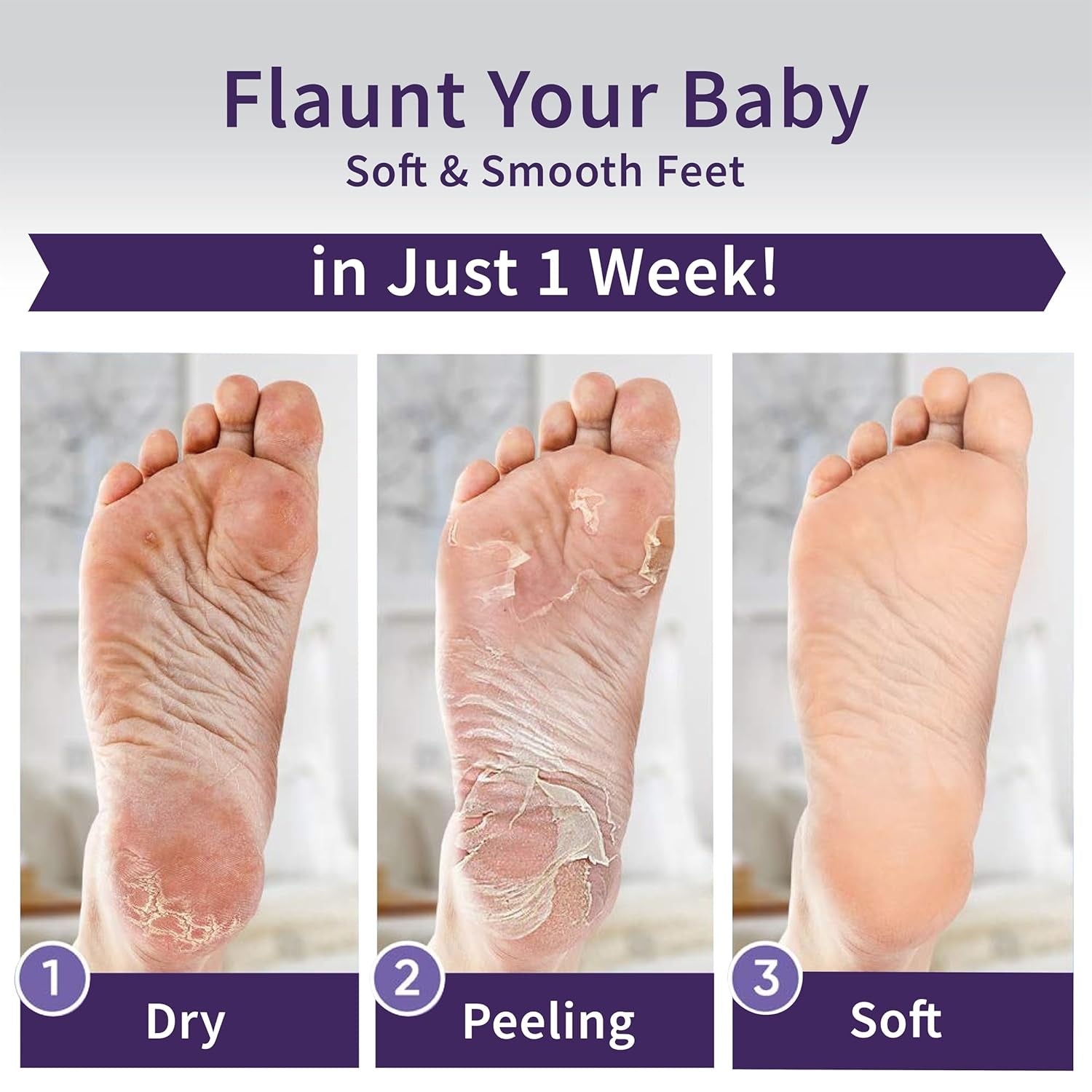 Foot Peeling Mask – Lavender Exfoliating Treatment Booties for Callus Removal & Renewal of Dry, Cracked Feet – Dermatologist-Inspired Moisturizing Spa Therapy for Men & Women (2 Pairs)
