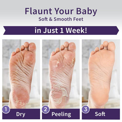 Foot Peeling Mask – Lavender Exfoliating Treatment Booties for Callus Removal & Renewal of Dry, Cracked Feet – Dermatologist-Inspired Moisturizing Spa Therapy for Men & Women (2 Pairs)