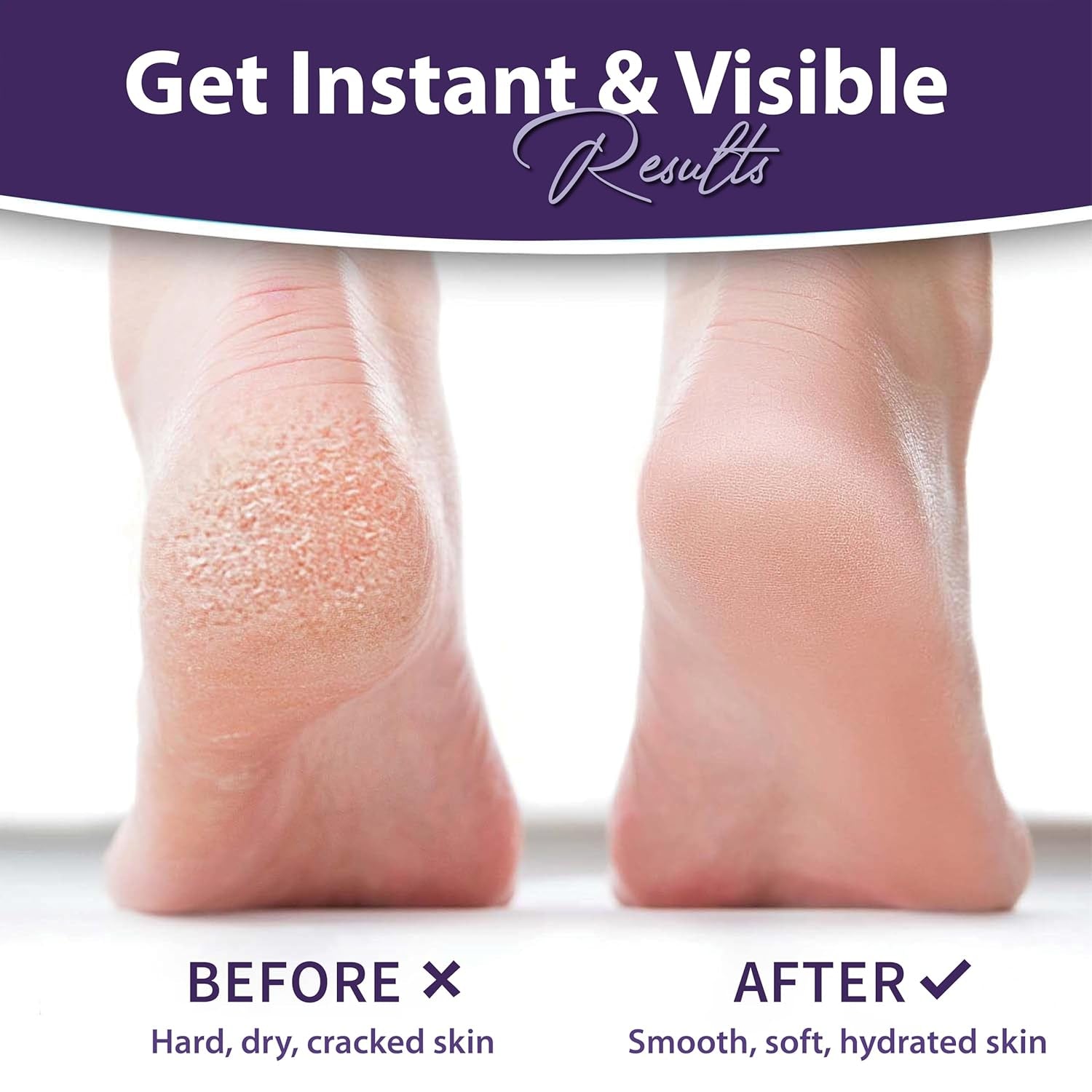 Foot Peeling Mask – Lavender Exfoliating Treatment Booties for Callus Removal & Renewal of Dry, Cracked Feet – Dermatologist-Inspired Moisturizing Spa Therapy for Men & Women (2 Pairs)