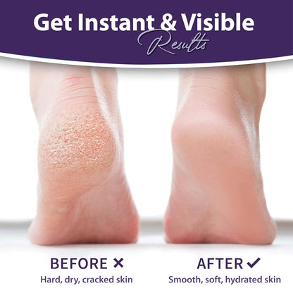 Foot Peeling Mask – Lavender Exfoliating Treatment Booties for Callus Removal & Renewal of Dry, Cracked Feet – Dermatologist-Inspired Moisturizing Spa Therapy for Men & Women (2 Pairs)